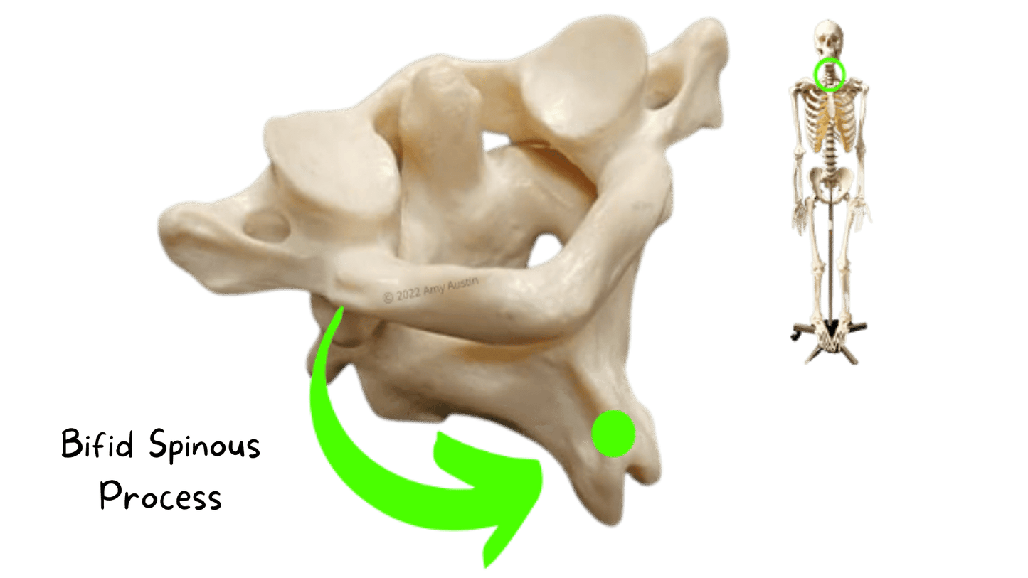 Axial Skeleton Anatomy Flashcards