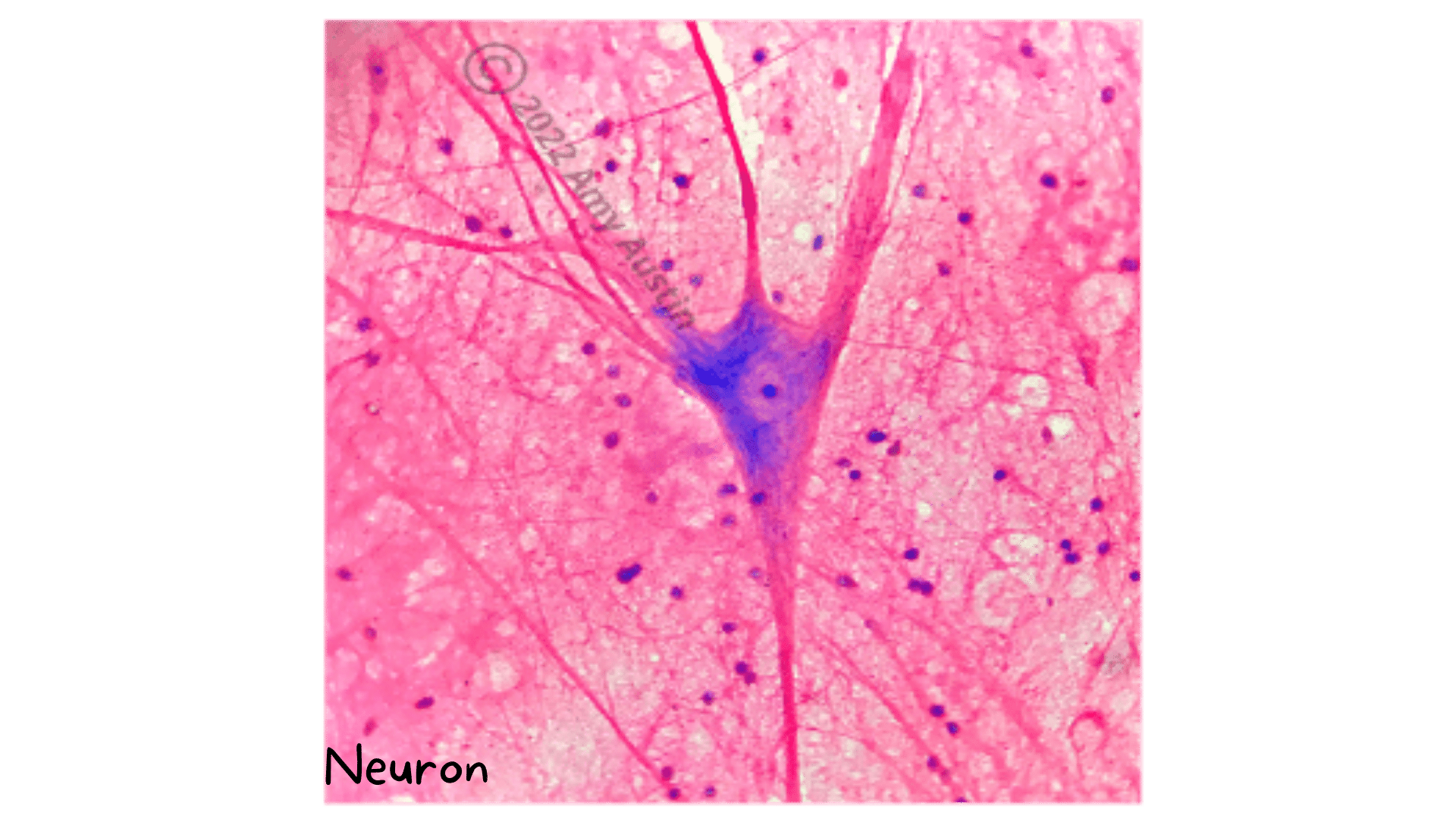 Neuron Tissue Iname Integumentary System and Tissues Part 2 Anatomy Flashcards – Bio in a flash