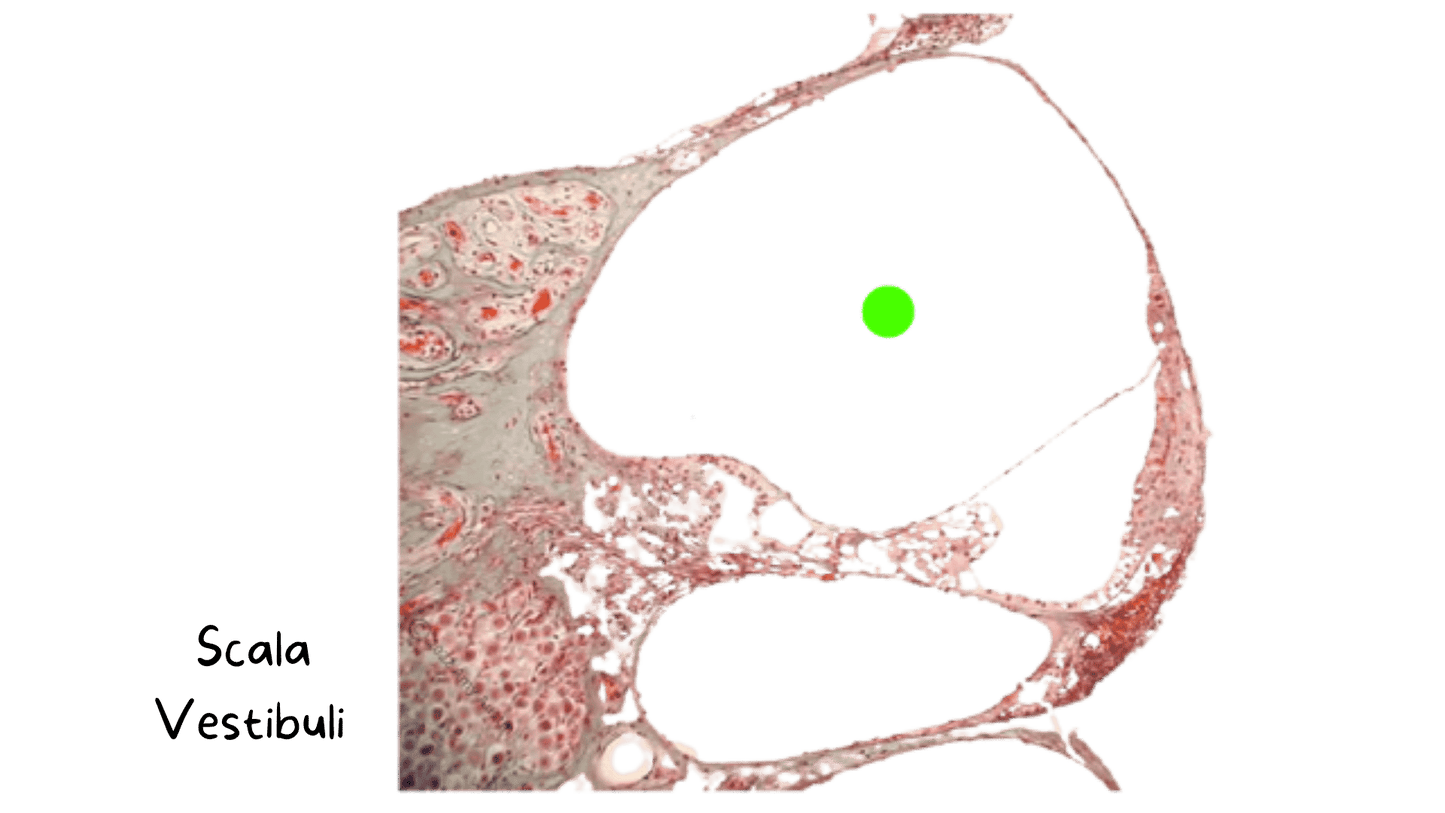 eFlashcards Cutaneous and Special Senses